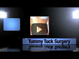 Chicago Tummy Tuck Abdominoplasty Surgery