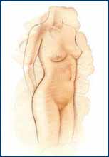 liposuction after
