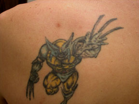 LASER TATTOO REMOVAL  REMOVE UNWANTED INK